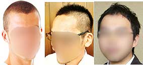 薄毛の種類と特徴 おすすめのヘアスタイル 男の髪型ナビ